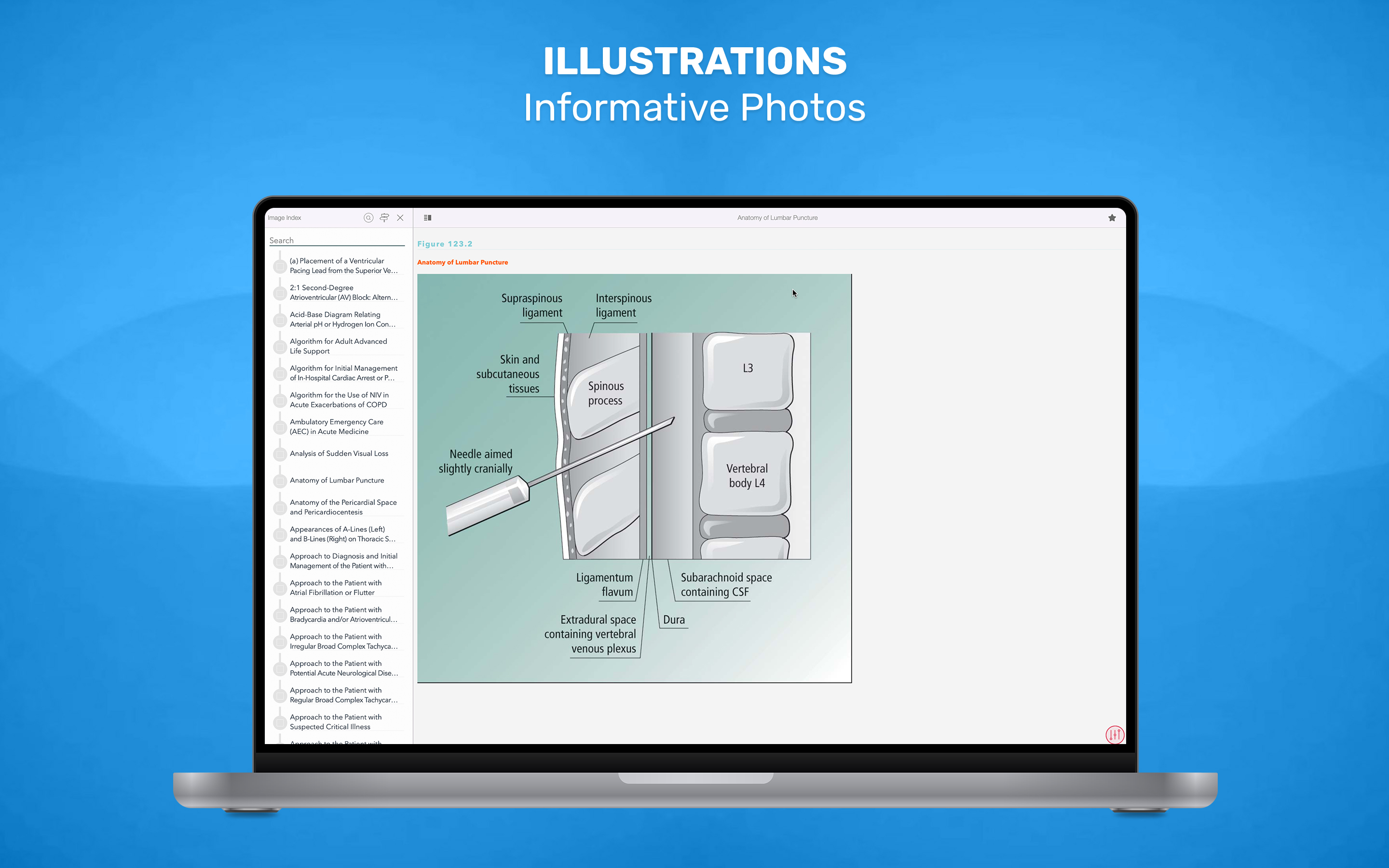 Acute Medicine screenshot 22