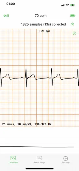 Game screenshot ECG EKG Viewer for Polar H10 mod apk