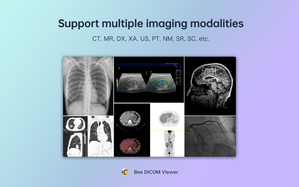 #2. Bee DICOM Viewer (macOS) 由: SinoUnion Healthcare Inc.