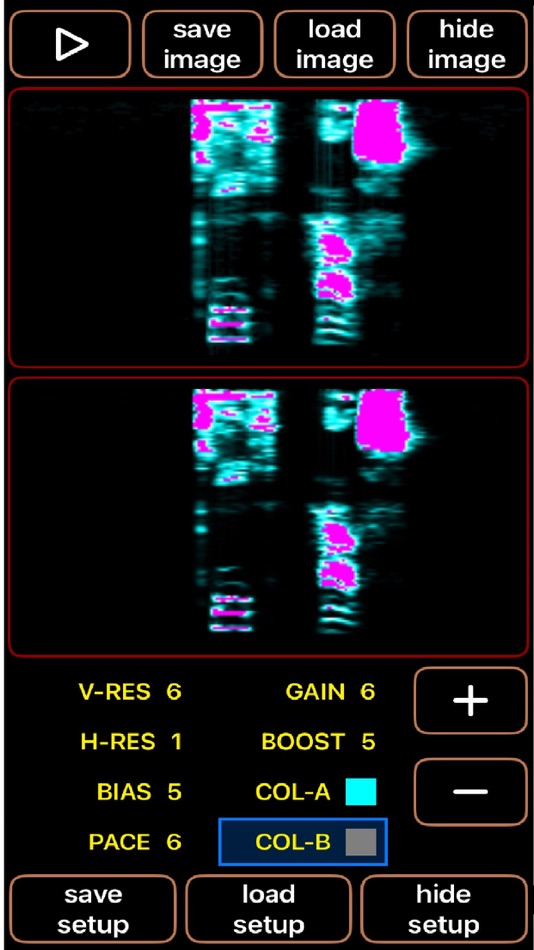 EyeSound Vocal (iOS) 由: keith house EyeSound Vocal (iOS) 由: keith house