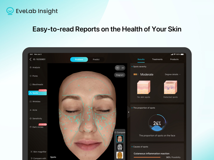 EveLab Insight Eve M