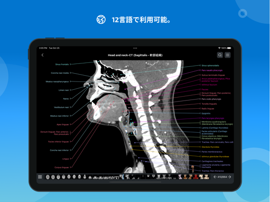 IMAIOS e-Anatomyのおすすめ画像7