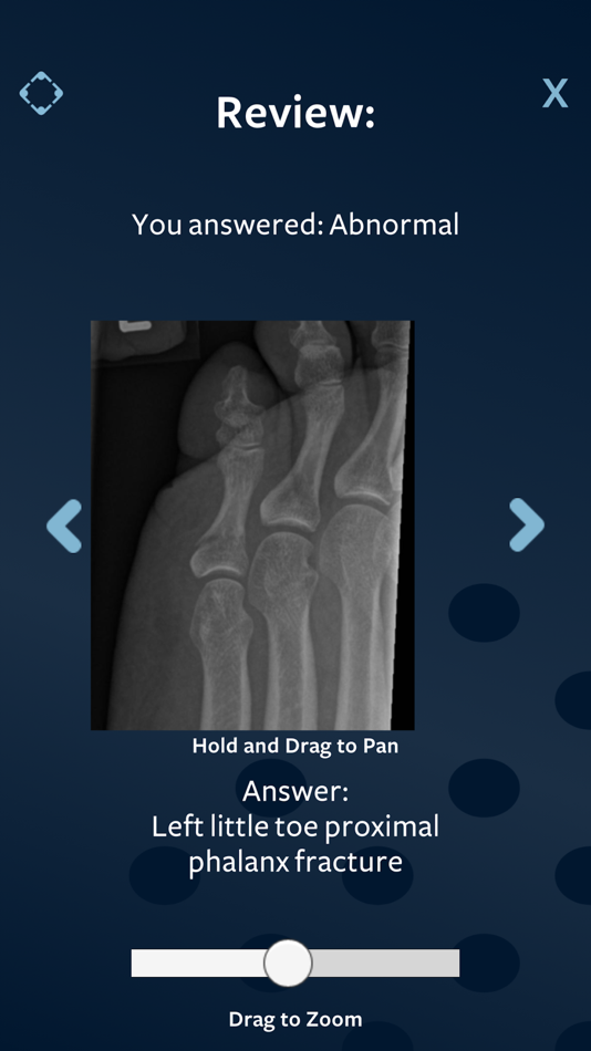 #5. Revise Radiology (iOS) 由: Revise Radiology