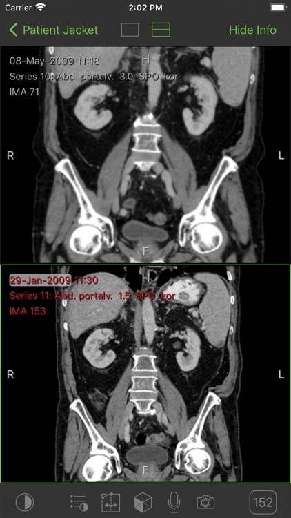 Visage Ease Pro screenshot-3