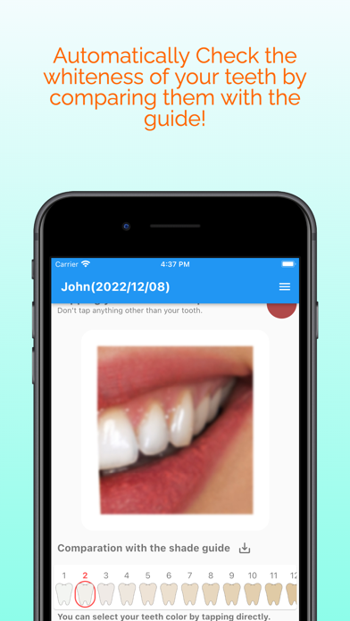 Teeth Whitening Diary Screenshot
