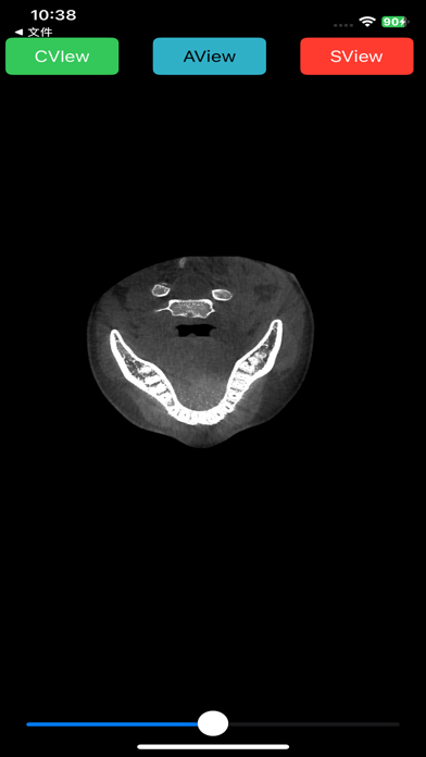 Screenshot 2 of Zumax NiiViewer App