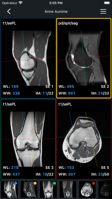 Screenshot #2 pour IDV - IMAIOS DICOM Viewer