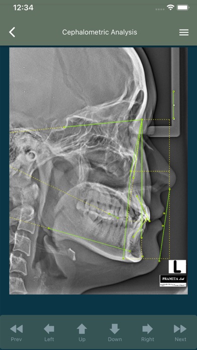 Orthoceph Screenshot 2 - AppWisp.com Orthoceph Screenshot 2 - AppWisp.com