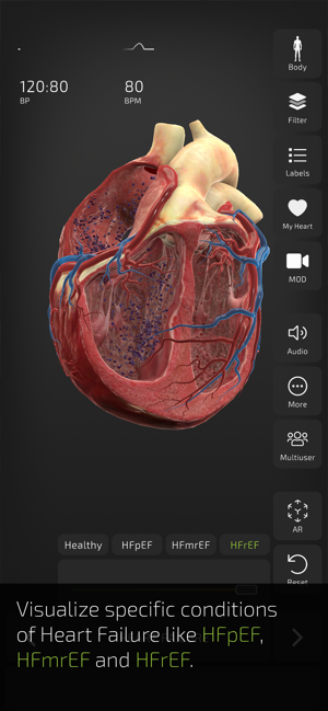 Captură de ecran INSIGHT HEART