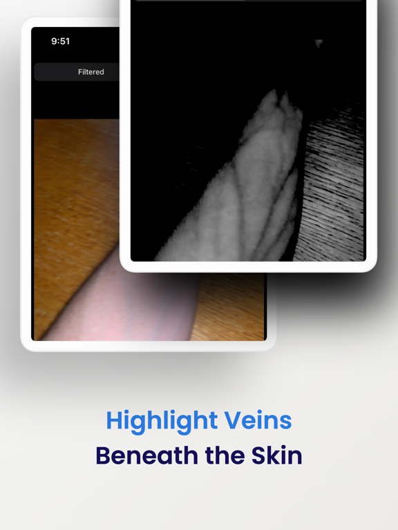 Screenshot #4 pour VeinSeek Pro