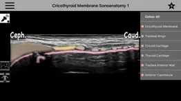 anso anaesthesia sonoanatomy problems & solutions and troubleshooting guide - 3