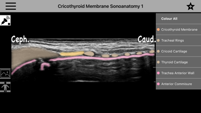 AnSo Anaesthesia Sonoanatomyのおすすめ画像1