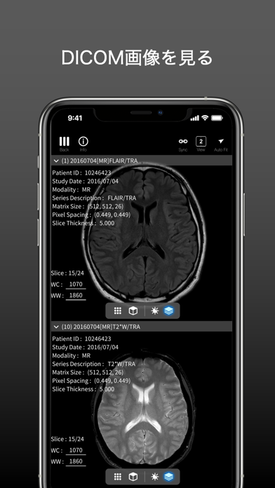 palm : DICOM & 3DModel Viewer紹介画像2