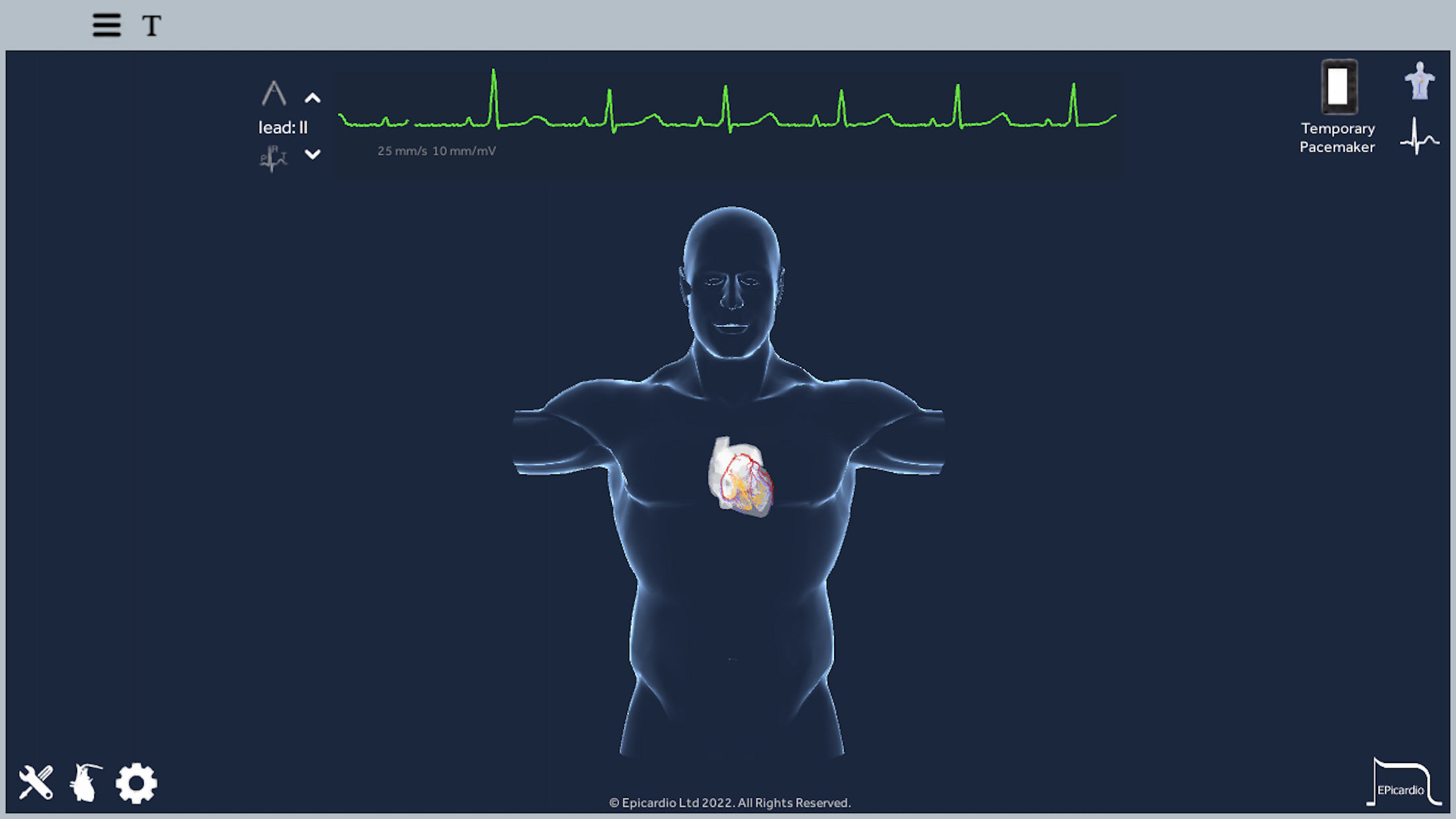 Epicardio Heart Simulator