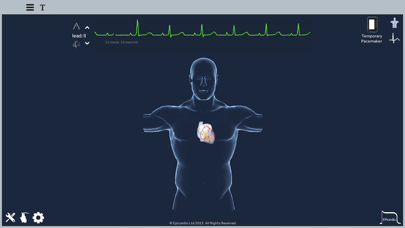Epicardio Heart Simulatorのおすすめ画像1