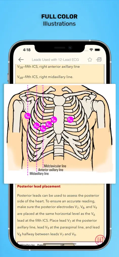 ECG Interpretation: Pkt Guide - Medical App | MWM