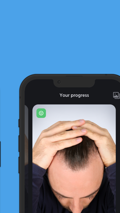 HairTrackr Screenshot