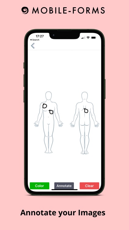My Mobile Forms Builder