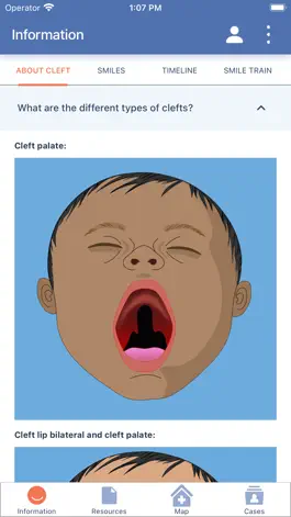 Game screenshot Cleft Care Companion mod apk