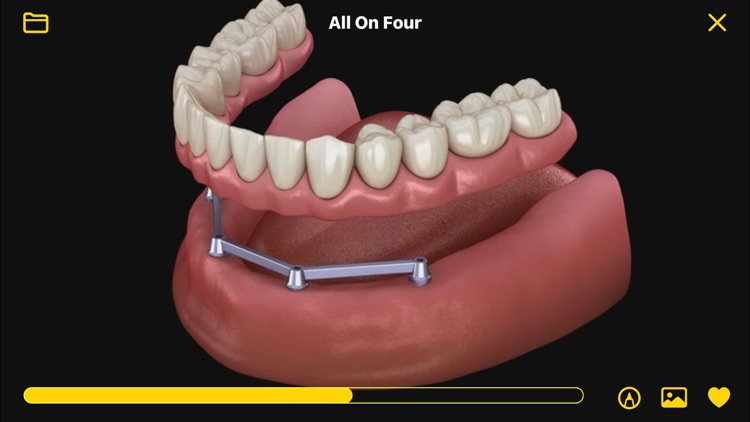 Dental Animations