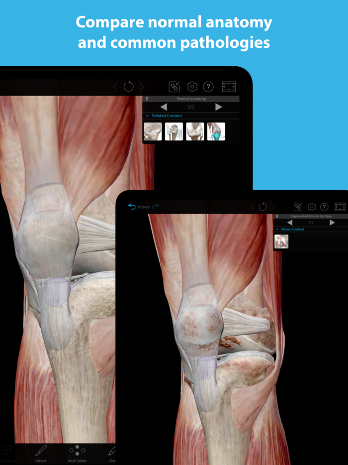 Muscles and Kinesiology