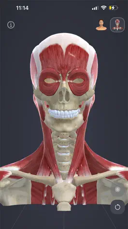 Game screenshot Chronic Migraine Anatomy apk