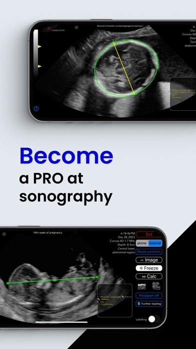 Scanbooster Ultrasound Sim Screenshot