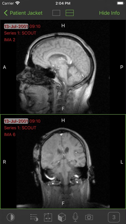 Visage Ease Pro screenshot-4