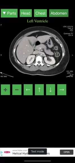 Game screenshot Anatomy on Radiology CT apk
