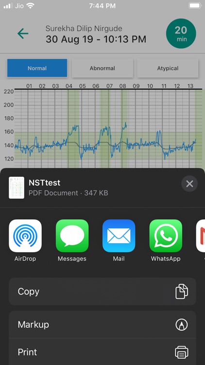 Fetosense Remote screenshot-6