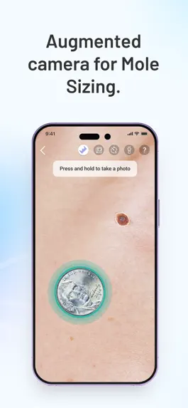 Game screenshot Miiskin Skin Tracker & eHealth hack