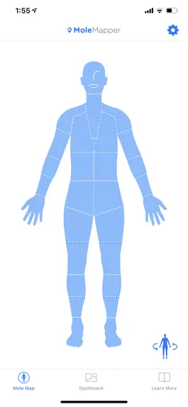 Game screenshot Mole Mapper Melanoma Study apk