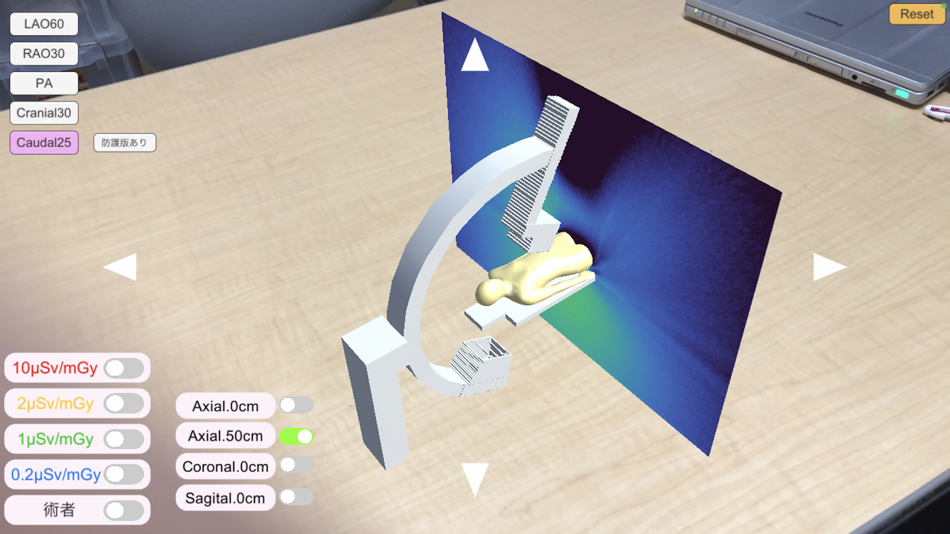 #1. X-SERVE IVR (iOS) 由: 九州大学