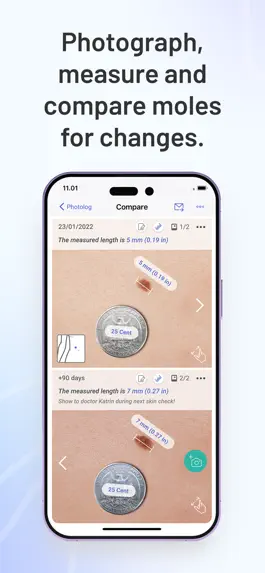 Game screenshot Miiskin Skin Tracker & eHealth mod apk