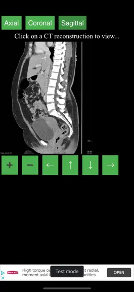 Game screenshot CT Abdomen Pelvis hack