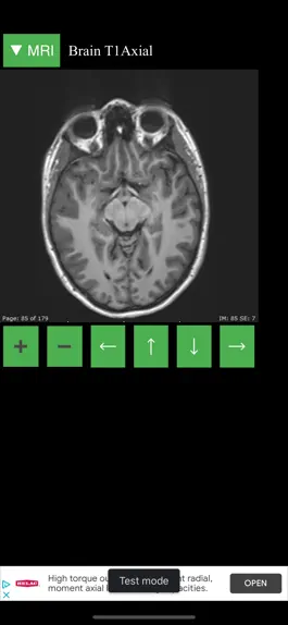 Game screenshot MRI Viewer mod apk