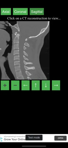 Game screenshot CT Cervical Spine apk