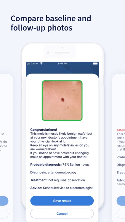 AI Dermatologist: Skin Scanner screenshot-5