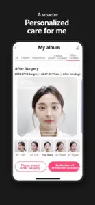 Natoo Facial&Skin AI Platform screenshot #5 for iPhone