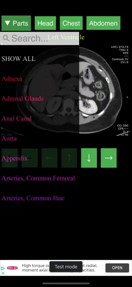 Game screenshot Anatomy on Radiology CT hack