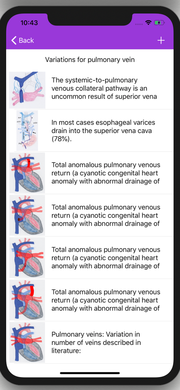 Vascular Variants