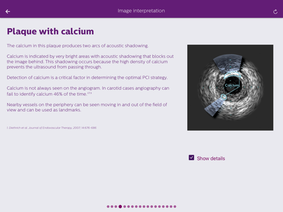 Screenshot #6 pour Philips Coronary IVUS Tutor