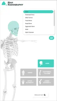navi radiography lite problems & solutions and troubleshooting guide - 1