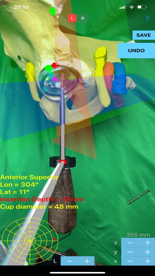 #5. ScrewCupNaviAR (iOS) 由: ORTHOPRACTIS.COM SINGLE MEMBER P.C.