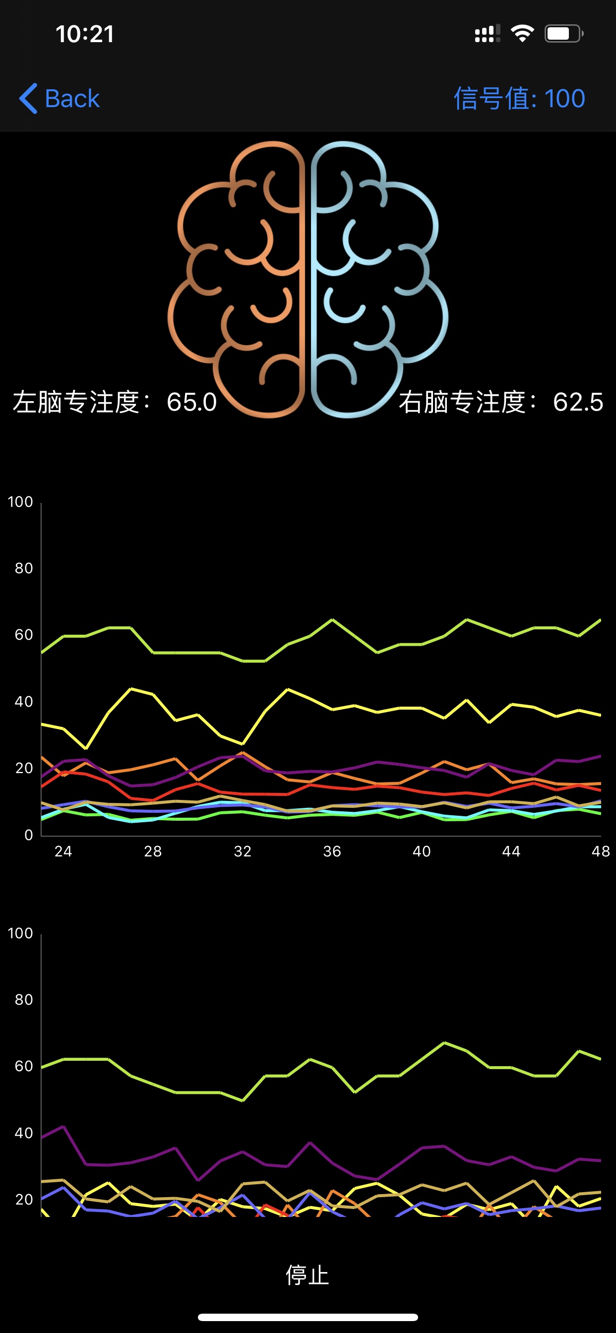 BrainLink Dualのおすすめ画像1