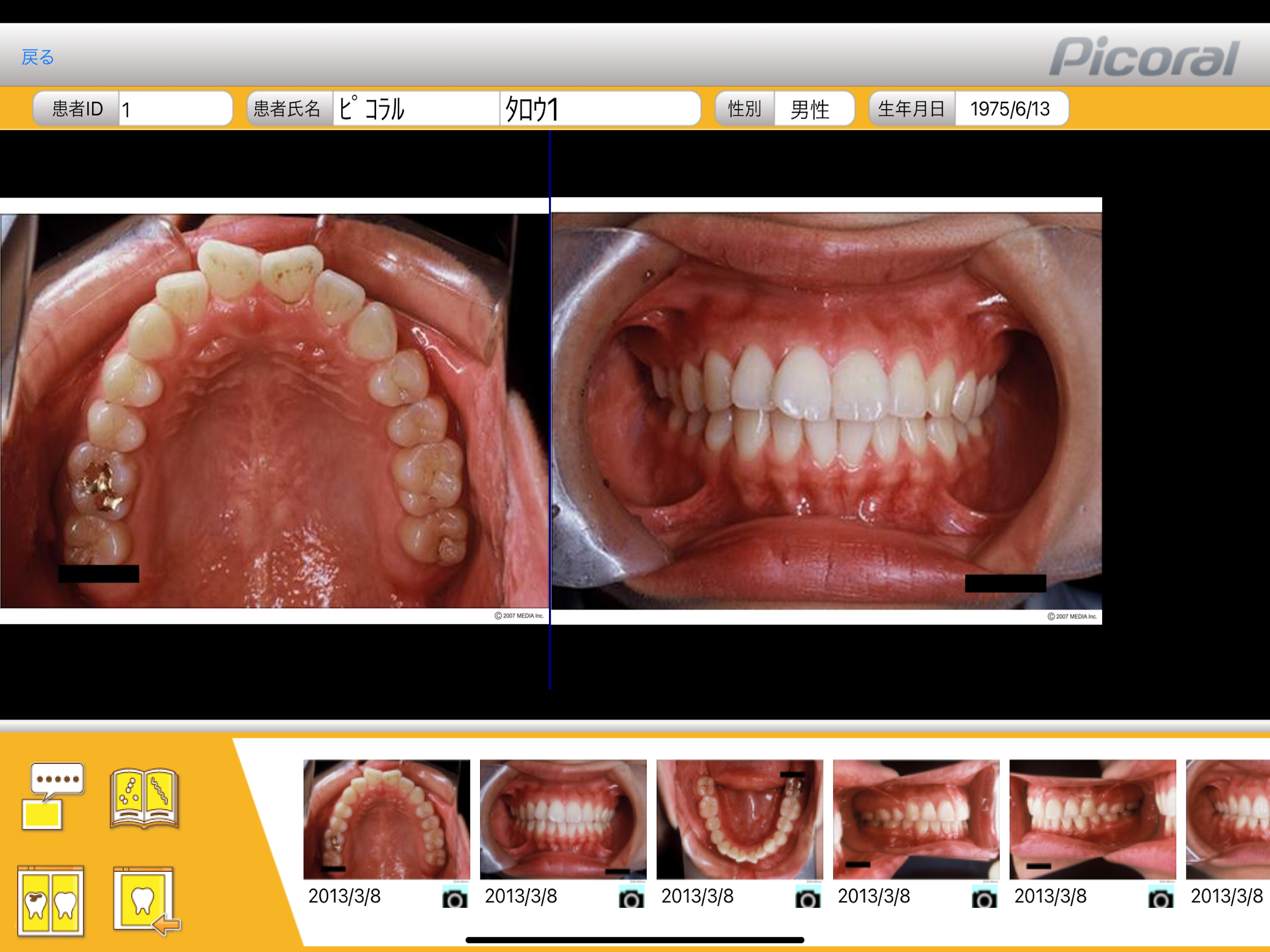 PicoralViewer