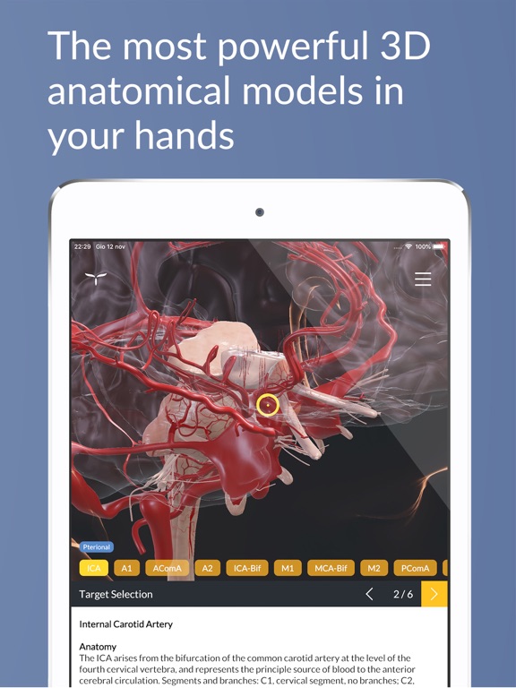 UpSurgeOn Neurosurgery iPad screenshot 6 - Medical app