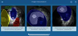 Game screenshot Philips Venous IVUS Tutor apk