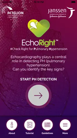 Game screenshot EchoRight mod apk