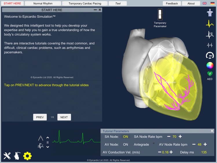Temporary Cardiac Pacing screenshot-5